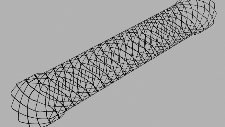 Metal Non-Covered Biliary Stents Have Become An Integral Part In Palliation Of Malignant Structures