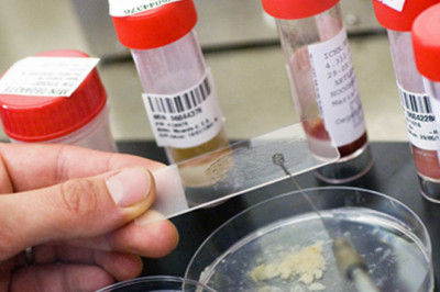 Pneumonia Diagnosis has become more important since the launch of Covid-19, resulting in an increase in demand for Pneumonia Testing.