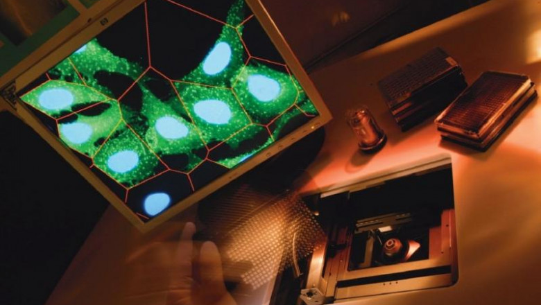 Hcs Systems Are Used For Almost All Stages Involved In Drug Discovery