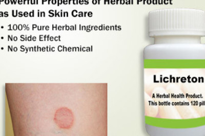 Home Remedies To Get Rid Of Lichen Planus