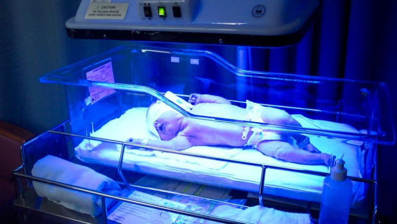 Infant Phototherapy Device Market Research Report and Clinical Outlook 2021-2030