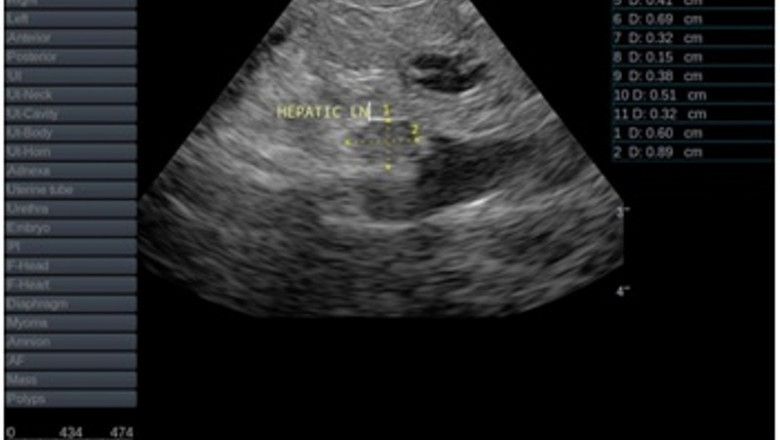 Types of Ultrasound Photos