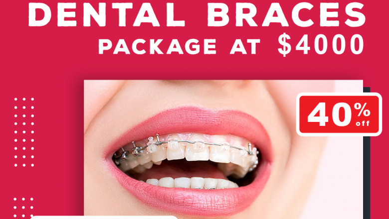 Dental clinic Albany | Valplast Braces Dentures | Elite Dental Care auckland