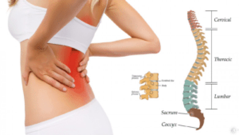 Back pain | Causes, exercises, treatments