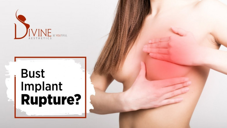 What is Breast Implant?