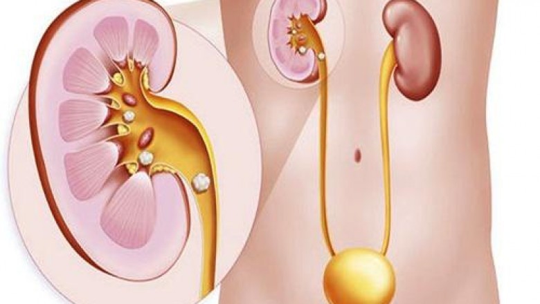 Kidney Stone Management Devices Market 2021 by New Market Opportunities, Production Cost Analysis, Market Development and Market Dynamics Forces