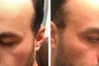 Thingsyou could do with your male lace front on