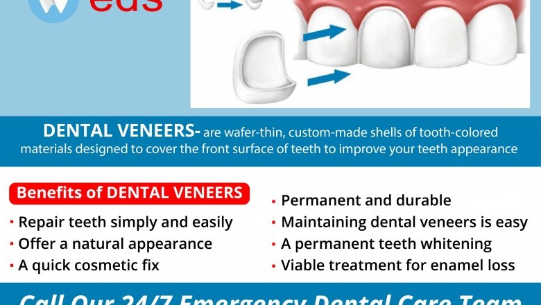 Benefits of Dental Veneers | Emergency Dentist 24/7
