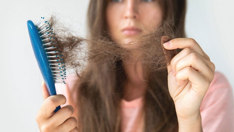Why Natural Hair Loss Treatment is the Best For Your Hair