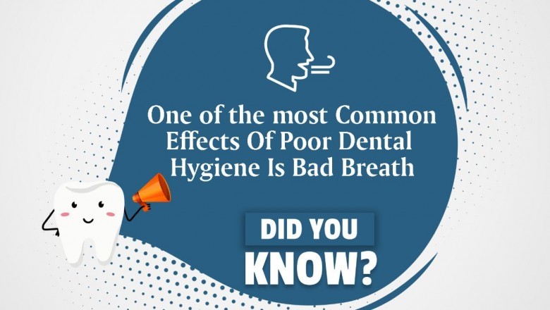 Root Canal Specialist in bhopal