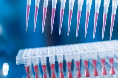 Diagnostic Testing of STDs has proven to be one of the most effective and accurate methods of diagnosing STDs