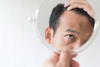 What To Do Before A Hair Transplant?