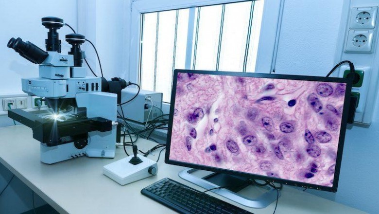 2018-2023 Digital Pathology Market Competitive Landscape, Business Strategy Analysis and Forecast Report