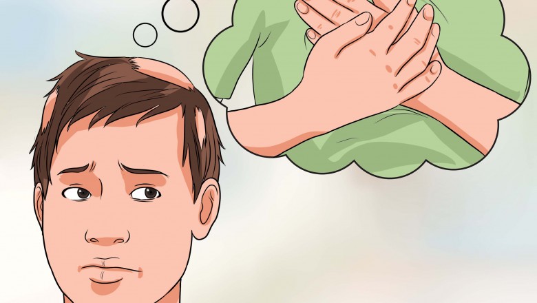 What are the Different Hair treatment Ways to Stop Hair Loss?