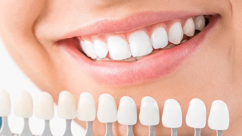 Cosmetic Dentistry Market to Witness 13.50% CAGR during forecast 2018 to 2023 - Exclusive Report by MarketResearchFuture