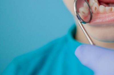 The introduction of advanced medical procedures such as dental fillings, dental caries treatment options have improved throughout time