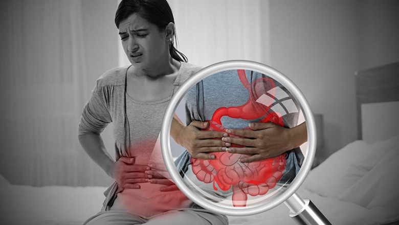 Know about Colonic Polyps