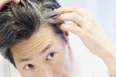 Hair Transplant Houston, Cost and Hair Loss Treatment