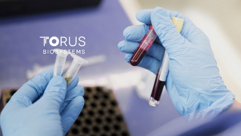 Health Diagnostics Company Torus Biosystems Raises $25 Million