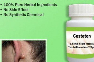 Natural Treatment for Sebaceous Cyst | Supplement | Herbs Solutions By Nature