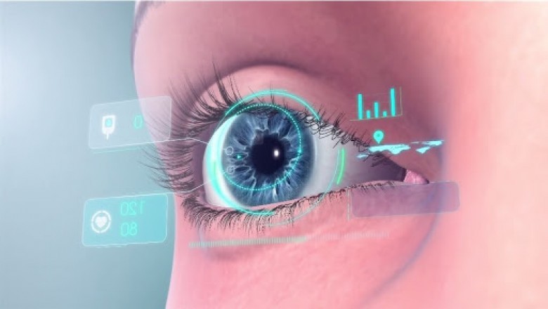 The Replacement Process, Surgical Components, Placement, and Positioning of an Ocular Implant
