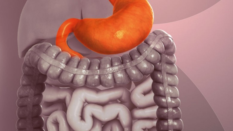 Gastroesophageal Reflux Disease (GERD) Treatment Devices Are Used To Treat GRED, Which Is a Chronic Disease Occurring Due To Acid Refluxes in the Stomach