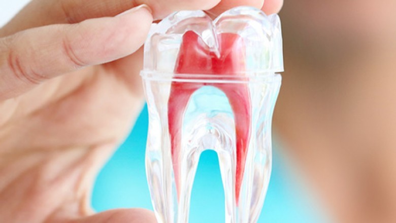 Best Root Canal Treatment in Gurgaon | Book Free consultation