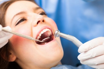 The Best Dental Crowns in Houston