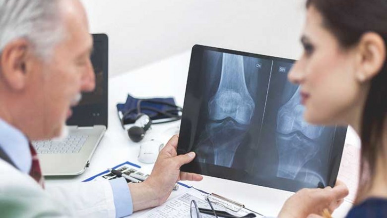 Fibrosarcoma Drugs Function By Preventing The Formation Of New Cancer Cells In The Body