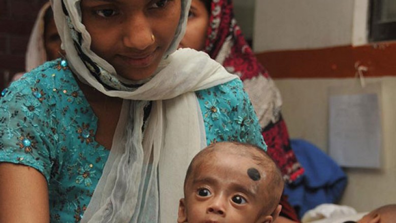 Food For Malnutrition Children In India