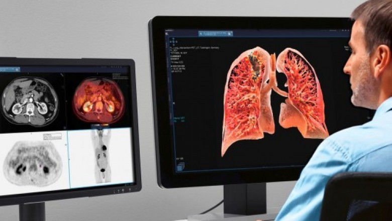Several serious and even life-threatening diseases can be diagnosed or detected via computer aided detection