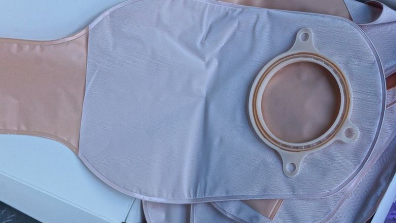 The rising number of patients diagnosed with Crohn's disease, Ulcerative Colitis, Bladder Cancer, and Colorectal Cancer, the global ostomy drainage bags market is expected to grow.