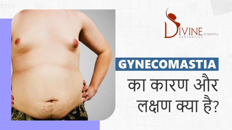 Gynecomastia Causes & Symptoms by Dr. Amit Gupta
