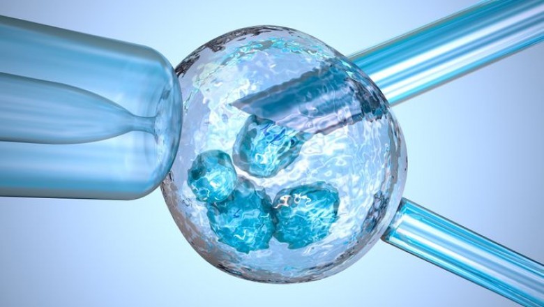 Preimplantation Genetic Testing | IVF-Infertility Specialists