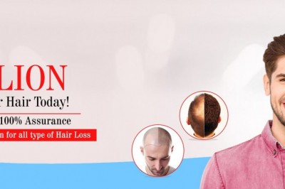 Hair Transplant, Best Hair Transplant, Hair Transplant Clinic in Ahmedabad, Gujarat, India