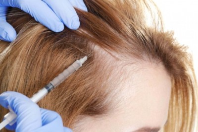 The Need For Hair Loss Treatments Is Predicted To Rise As The Incidence Of Alopecia (Hair Loss) Rises