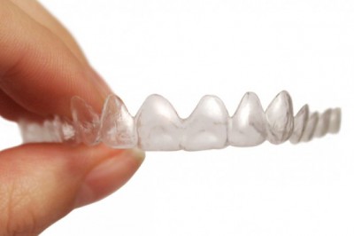 3 Unique Things to understand About Invisalign Aligners | bluewaterdentalfl