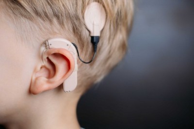 Cochlear Implants are a type of hearing aid that allows people with hearing loss to hear well and live a normal life
