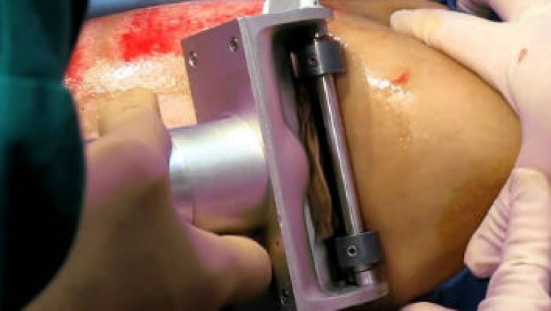Dermatome is a new product that aids in the development of healthy, youthful skin
