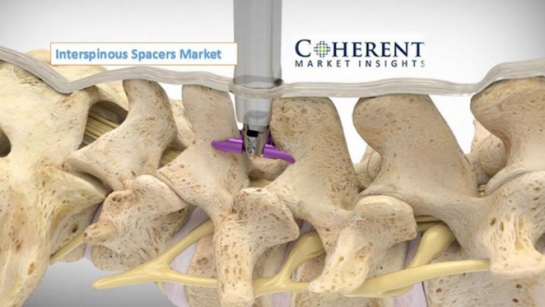 Interspinous Spacers Market Size, Trends, Shares, Insights and Forecast – 2018-2026