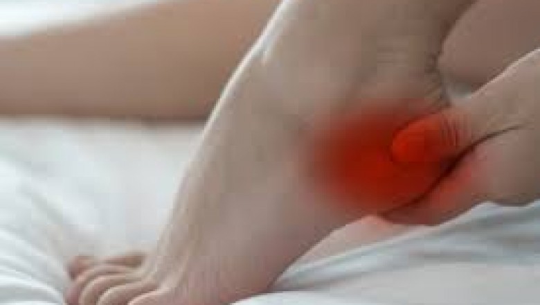 How to Mitigate Plantar Fasciitis Pain With Chiropractors?