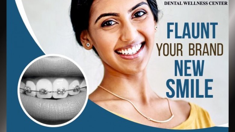 Dental Doctor In Bhopal Smile Gallery