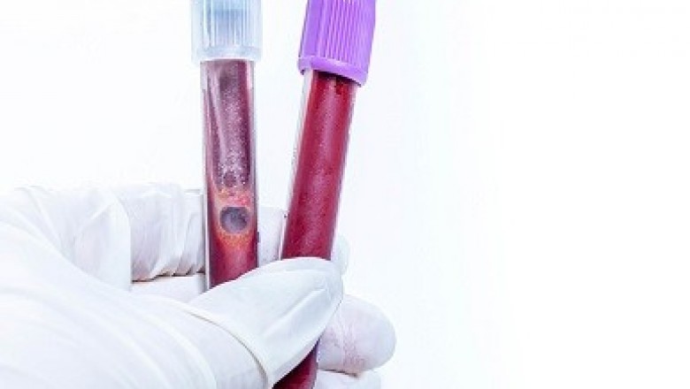 Blood Collection: Crucial Step to Diagnose