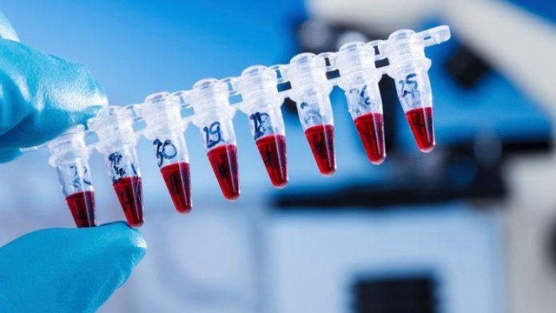 Non-Invasive Cancer Diagnostics Market is expanding rapidly with LabCorp launching a non-invasive test ctDx Lung for patients with non-small cell lung cancer