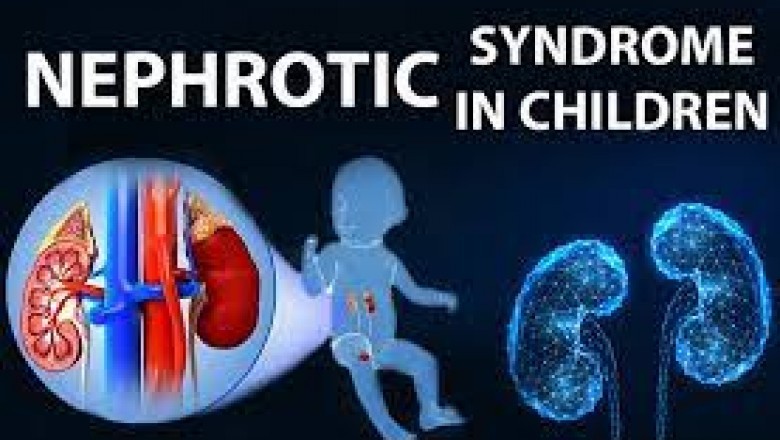 nephrotic syndrome in children