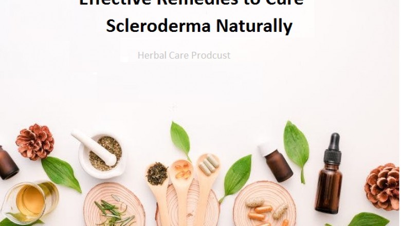 Effective Remedies to Cure Scleroderma Naturally