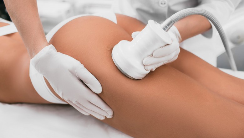 How Does Cavitation Machine Work To Remove Fat?