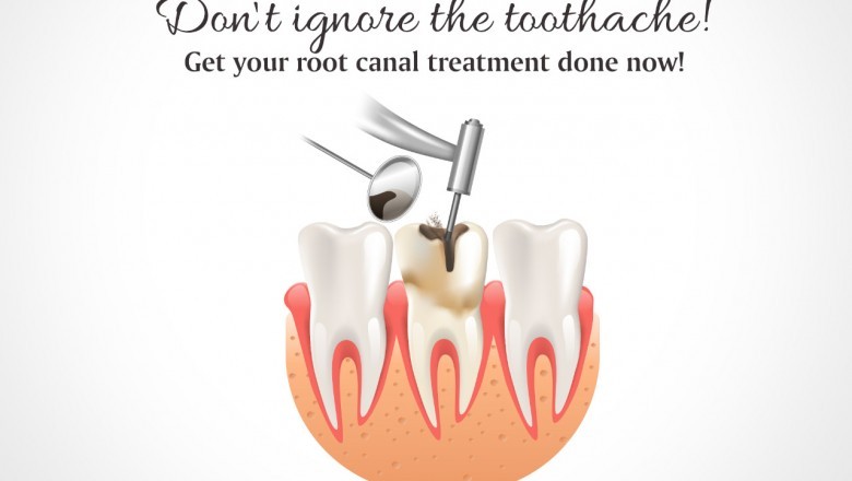 Smile Gallery BRACES THE ORTHODONTIC TREATMENT IN BHOPAL