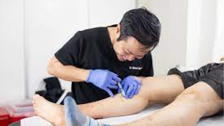 Vein Treatment Specialist Houston