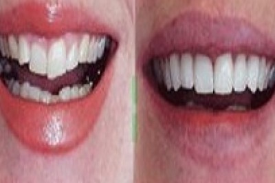 Dentist Norfolk